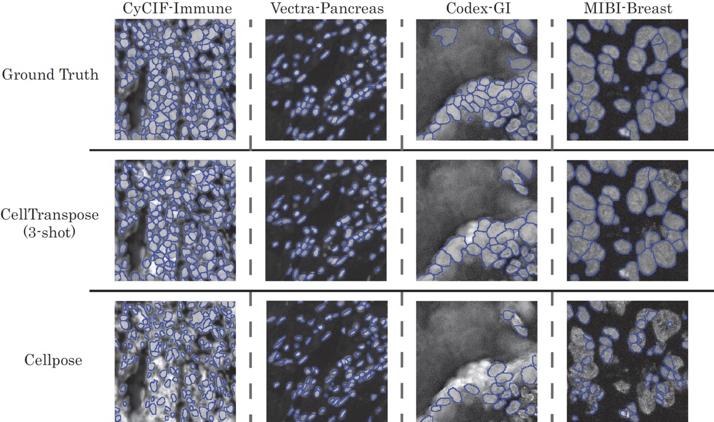 Qualitative segmentation results